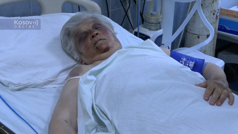MASKIRANI NAPADAČI PRETUKLI ŽENU U SEVERNOJ MITROVICI Božana: Tukli su me više do pola sata, hteli su da me opljačkaju, između sebe su pričali na albanskom (FOTO/VIDEO)
