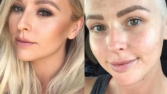 GREŠKA LEKARA JE UMALO KOŠTALA ŽIVOTA Odbili su da joj urade mamografiju, ubrzo je čula jezivu dijagnozu!