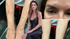 SEVERINA JE ŽRTVA NASILJA, PODNEĆE KRIVIČNU PRIJAVU Oglasila se pevačicina advokatica i otkrila šta je prethodilo svađi sestara Vučković