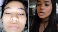 NOVA PRIRODNA TEHNIKA ZA SMANJENJE NOSA ZALUDELA JE CEO SVET Mnogi tvrde provereno radi dok drugi sumnjaju