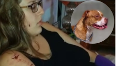 DVE ŽENE SU OTIŠLE NA TRČANJE, PA IH NAPALA ČETIRI PITBULA: Kidali su im meso i mišiće, prizor je bio jeziv, a spasila ih je slučajna prolaznica (VIDEO)