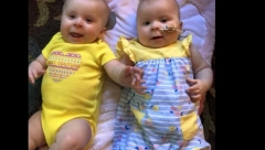 BLIZNAKINJE SU ROĐENE KAO SAVRŠENO ZDRAVE BEBE Samo tri dana nakon što su došle kući krenula je borba za njihov život!
