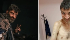 IZDEFORMISAN I NEPREPOZNATLJIV Evo kako sada izgleda "pijanista", borac zloglasnog AZOV-a (FOTO)