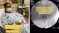 DOKTORI SU GODINAMA IGNORISALI NJENE BOLOVE Ono šta su pronašli na jajniku joj je uništilo život - Zarobljena sam u telu penzionera