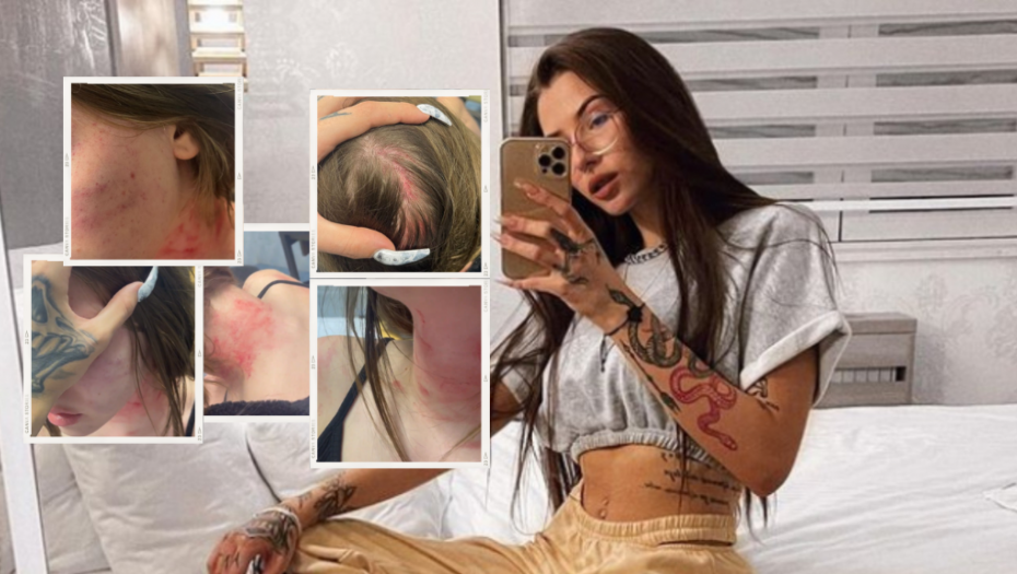 SESTRA UKI Q SASLUŠANA U POLICIJI Pristala da krivično goni supruga koji ju je brutalno pretukao