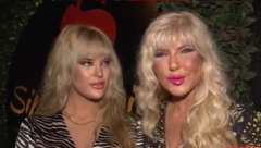 MOJE LICE KAO DOKAZ DA BOG POSTOJI Oglasila se ćerka od Jami nakon komentara da je operacijama promenila lični opis