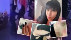UDARAO ME JE PESNICAMA PO GLAVI I POTILJKU Ana (22) koju su pretukli kineski radnici otkriva detalje incidenta (VIDEO)