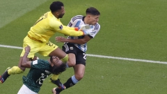 ISPRAVKA: Stravičan rendgen glave ne pripada fudbaleru Saudijske Arabije povređenom na Svetskom prvenstvu