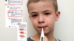 "OBUCI MU NEŠTO CRVENO DA BOGINJE IZAĐU ŠTO PRE": Ako slušate "doktore" sa mamećih Vajber grupa, dobro su vam deca i živa