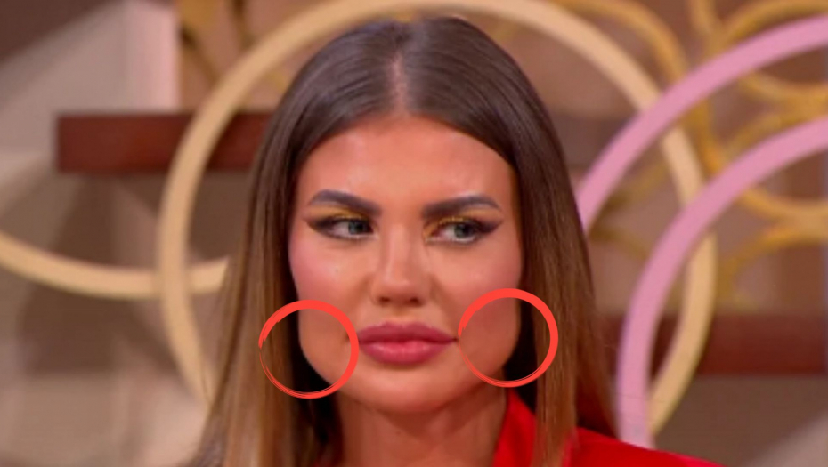 "KAO NOVI MATEMATIČKI IZRAZ, JOŠ NEOTKRIVEN" Dragana Mitar se UNAKAZILA PLASTIČNIM OPERACIJAMA, urnišu je zbog preterivanja! (FOTO)