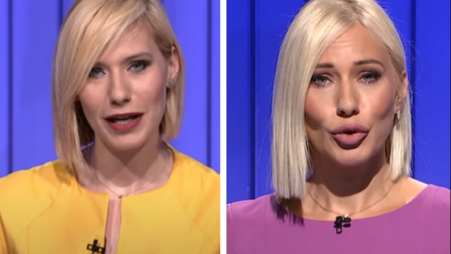 "ZNATE ŠTA SAM RADILA NA LICU" Marija Veljković progovorila o estetskim korekcijama, VODITELJKA OTKRILA PRAVU ISTINU