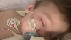 BEBA ZBOG KOMPLIKACIJA ZAVRŠILA NA RESPIRATORU: Ovaj virus najviše pogađa decu i stare, a ovi simptomi se mogu rano uočiti