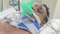 METLOM PREBIO INVALIDA, PA GA BACIO KROZ PROZOR Policajac uhapšen u Italiji zbog pokušaja ubistva Srbina! (UZNEMIRUJUĆA FOTOGRAFIJA)