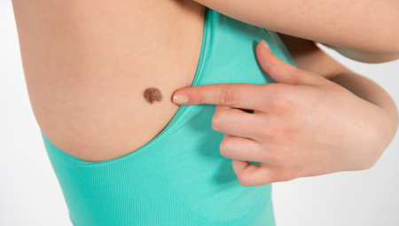 OVAJ SIMPTOM NIJE SMELA DA IGNORIŠE Ženi počeo da KRVARI MLADEŽ, pa saznala da ima PET TUMORA na srcu