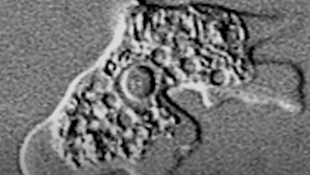 PREMINUO DEČAK OD OPASNE ZARAZE MOZGA Svi zaraženi izgubili život, ameba izazvala smrtonosnu infekciju u Indiji