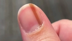 MARIJA JE MISLILA DA JE LINIJA NA NOKTU NJEN ZAŠTITNI ZNAK Iza svega se krila jeziva istina, da nije bilo jednog doktora više ne bila živa