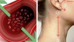 TVRDNJA POZNATOG KARDIOLOGA Vratite pritisak u normalu za samo 5 minuta, bez lekova