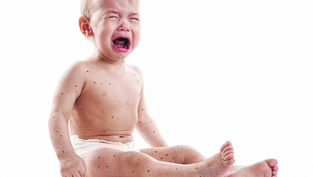 Antivakseri se opamete tek kad krene epidemija!