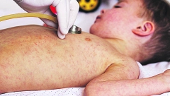 Male boginje se šire!