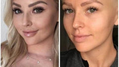 DOKTORI SU MISLILI DA JE PREMLADA ZA BOLEST Posle osam meseci otkrila je strašnu dijagnozu!