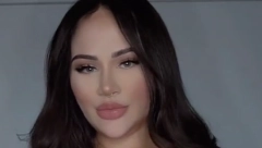 MANJE OD 110 LJUDI IMA OVAJ POREMEĆAJ Pamelija (27) pati od veoma retkog stanja, zbog toga ima JAKE bolove u ramenima i kičmi