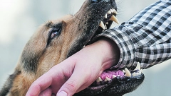 Saveti šta da radite ako vas napadne agresivan pas NE MAŠITE RUKAMA I NE VIČITE!