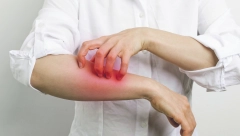 ŠUGA I VAŠKE NAPALE DECU U SRBIJI