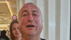 POTPUNO IZGOREO NA SUNCU Đani na mukama (FOTO)