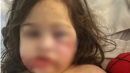 DEVOJČICA (3) JE ŽELELA PSA: Roditelji su udomili Pitbula, a onda je usledila drama - Dete više nikada neće moći da se nasmeje