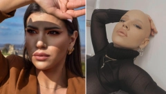 VIL SMIT JE ĆELAVOST SVOJE ŽENE BRANIO ŠAMAROM: Sonju iz Beograda je alopecija naučila da kosa nije simbol ženstvenosti i lepote