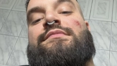 NASTUPI POZNATIH PEVAČA PUNI NASILJA, PUCNJAVI I BOMBI! Neki su prošli sa manjim povredama, a on je jedva živu glavu izvukao!