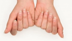 DAJTE URIN NA PREGLED Šta znače vertikalne, a šta horizontalne linije na noktima? Shvatite ozbiljno ove znakove