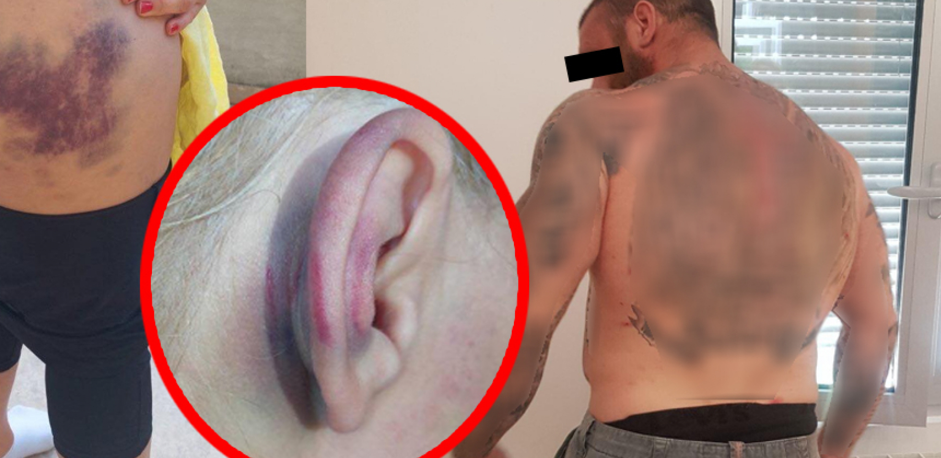 TUKAO ŽENU, BRATU SLOMIO NOS I LOBANJU Specijalci sa dugim cevima hapsili nasilnika na Čukarici (UZNEMIRUJUĆI FOTO)