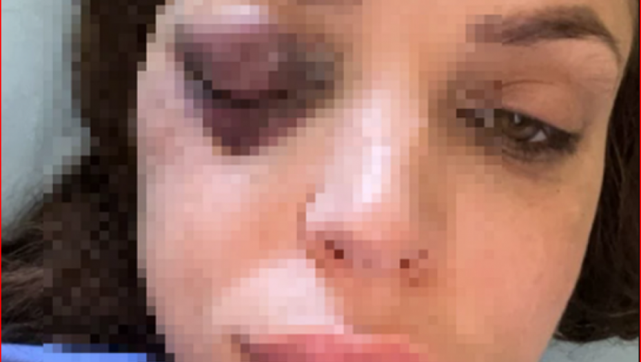 MUŠKARCIMA SU ŽENE ZA SVE KRIVE Vesna Stanojević za Alo! žestoko reagovala uvrede na račun pretučene Nataše Šavije