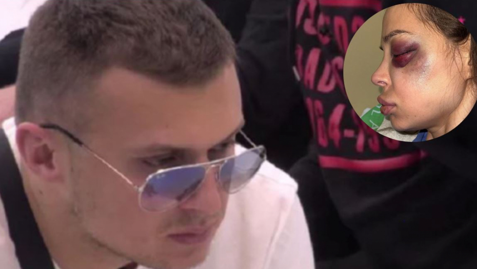 EVO ŠTA SE UPRAVO DEŠAVA SA KARIĆEM Nataša tvrdi da ju je krvnički pretukao, nestao s lica mesta, a sada stigle neočekivane vesti! (FOTO)