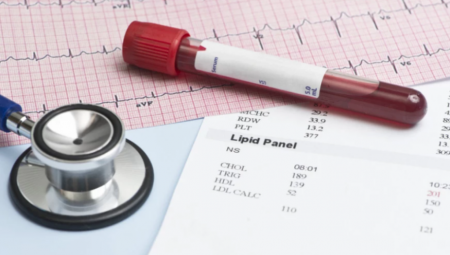 SVE OPASNOSTI HOLESTEROLA Kardiolog izričit: suplementi ne mogu da zamene lekove, mada ipak preporučuju jednu namirnicu