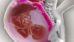 SNIMAK ZBOG KOG JE BEZ TEKSTA OSTALO DVA MILIONA LJUDI Pogledajte kako se organi trudnice pomeraju u trudnoći