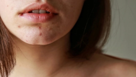 MISLILA JE DA JE PREVIŠE STARA ZA BUBULJICE Ispostavilo se da ima ozbiljnu bolest