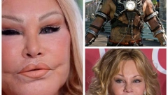 MALO SU PRETERALI Ovo su poznate ličnosti kojima su plastične operacija umalo došle glave