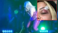 POKAZIVALA DVOGLAVOG ORLA, PA JE POGODILI U GLAVU! Albanska pevačica žestoko provocirala, skandal o kom je brujao svet