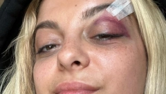 ALBANSKA PEVAČICA POKAZIVALA DVOGLAVOG ORLA Ponovo provocirala na nastupu, pa izbio skandal (VIDEO)