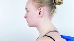 ZDRAVLJE Hormoni moraju da budu u balansu: Odgovori na neka od najvažnijih pitanja u vezi s Kušingovim sindromom