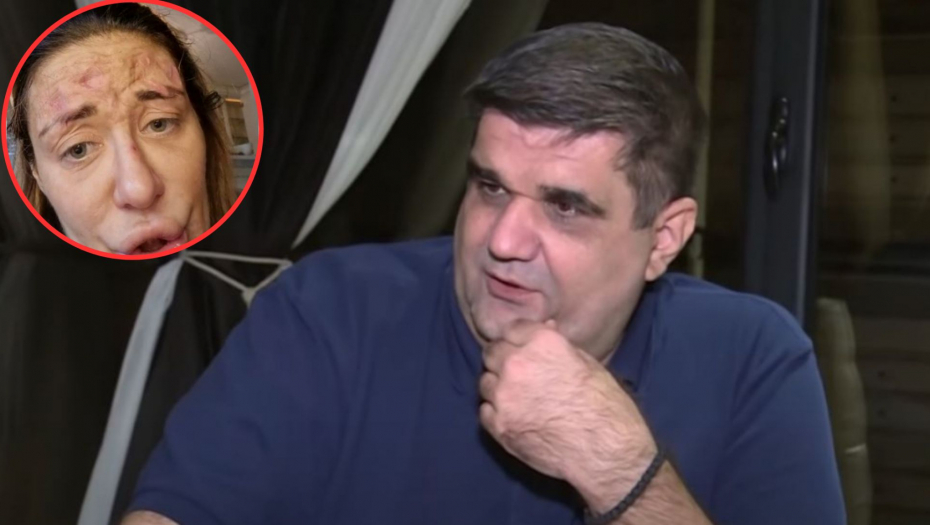 NIJE U STANJU DA ODRŽI KONCERT, ŽELIM JOJ DA SE IZLEČI! Saša Mirković se oglasio, pa Ani Nikolić poručio samo jedno!
