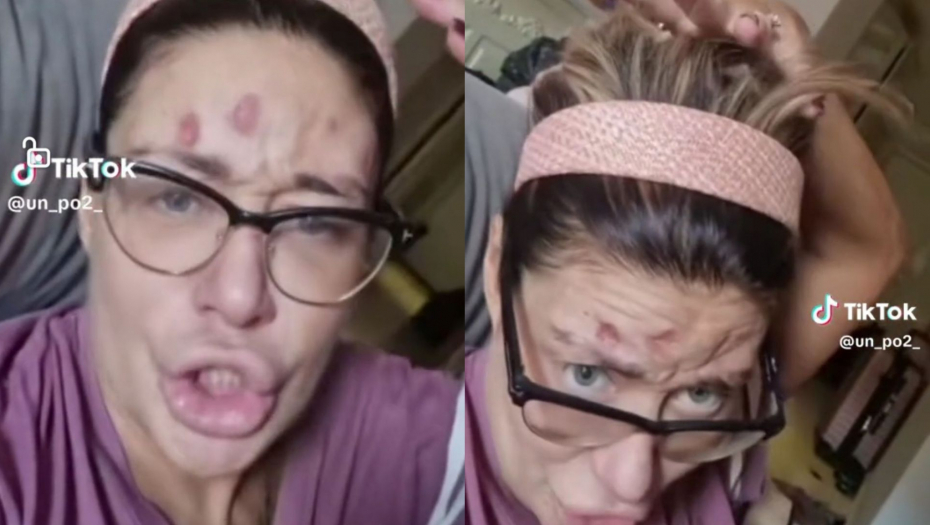 NOVI UZNEMIRUJUĆI SNIMAK! Ana Nikolić kuka na sav glas i moli da joj se uplati novac: Dobiću vaške, vidi na šta ličim (VIDEO)