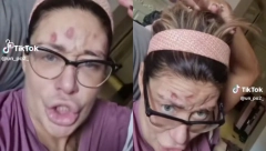 NOVI UZNEMIRUJUĆI SNIMAK! Ana Nikolić kuka na sav glas i moli da joj se uplati novac: Dobiću vaške, vidi na šta ličim (VIDEO)