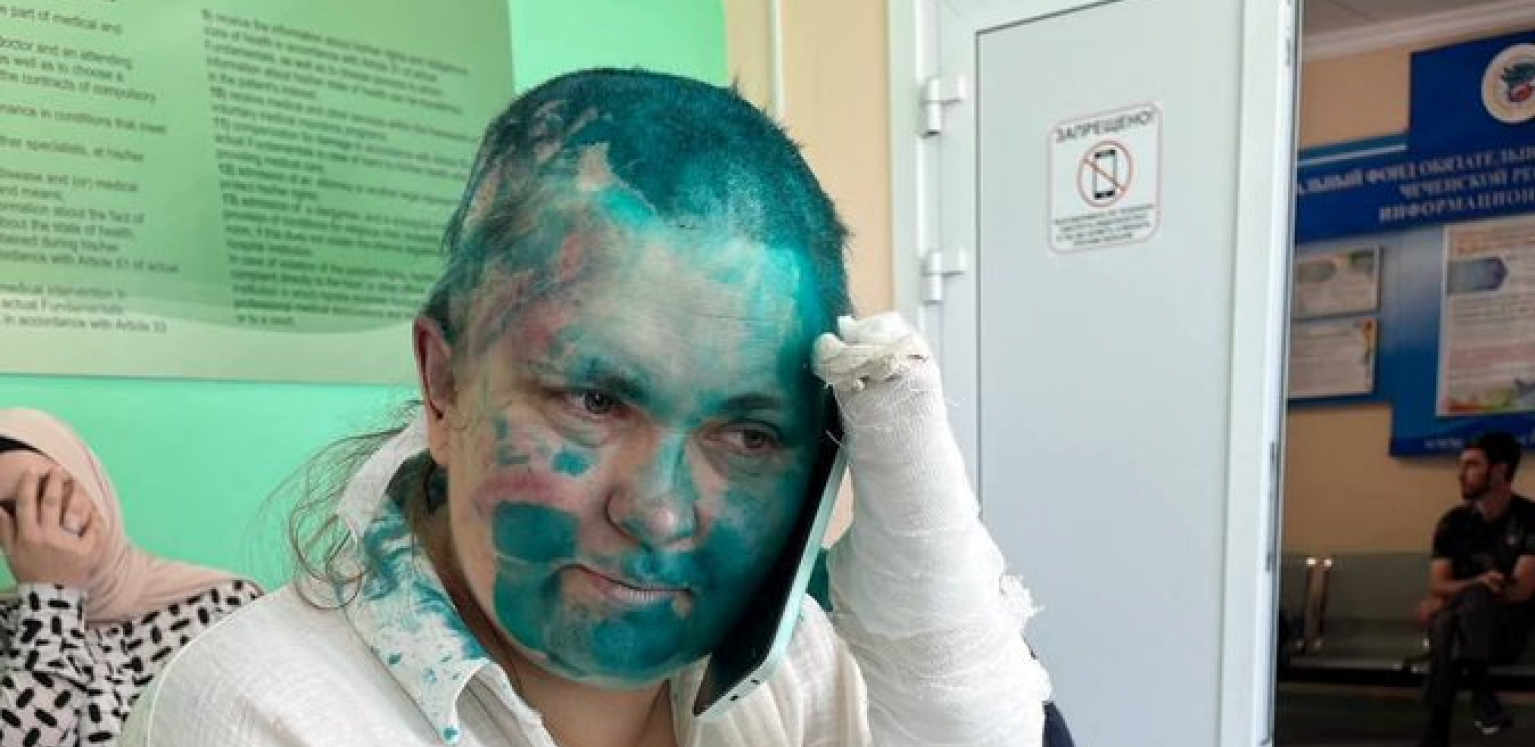 OBRIJALI JOJ GLAVU, ZALILI JE FARBOM! Čečeni uhvatili prozapadnu novinarku, slike zapalile mreže! (FOTO)