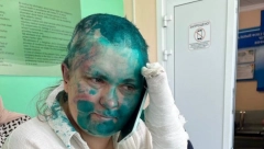 IZVUKLI JE IZ KOLA, A ONDA SU IZVADILI MOTKU Detalji napada na rusku novinarku, Čečeni joj ovo nisu oprostili