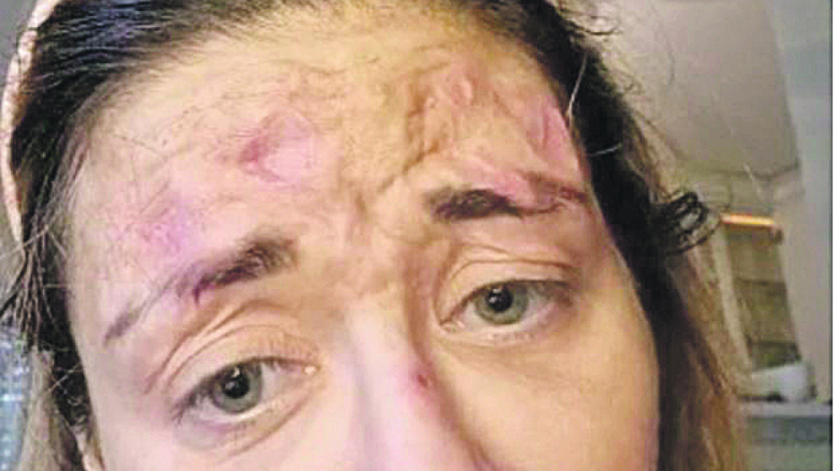 TUŽNO! Od fatalne bombe do živih rana na licu