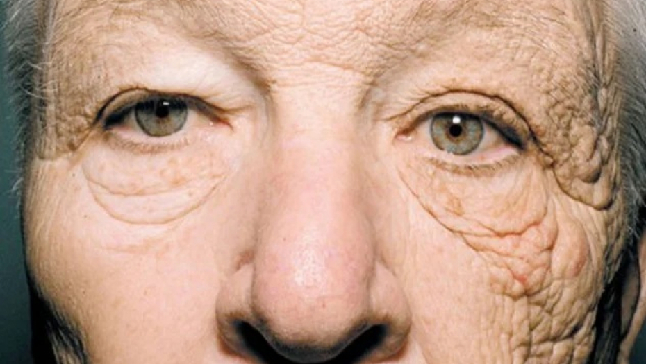 NEVEROVATNE PROMENE Fotografija vozača kamiona zaprepastila svet, niko ne veuje šta mu je sunce "uradilo"