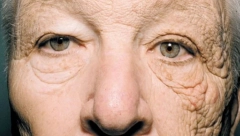 NEVEROVATNE PROMENE Fotografija vozača kamiona zaprepastila svet, niko ne veuje šta mu je sunce "uradilo"